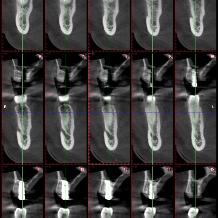 How CBCT scans can detect cancer, DentalRay posted on the topic